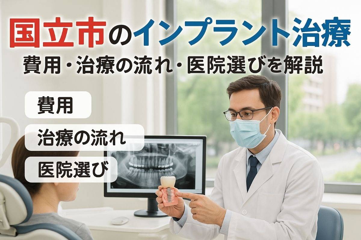 国立市でインプラントの費用や治療の流れと医院選び完全ガイド
