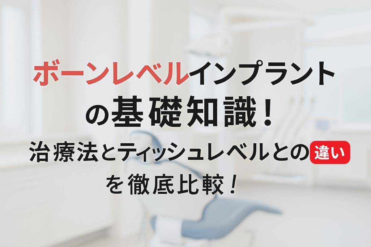 ボーンレベルインプラントの基礎知識！治療法やティッシュレベルとの違いを徹底比較！