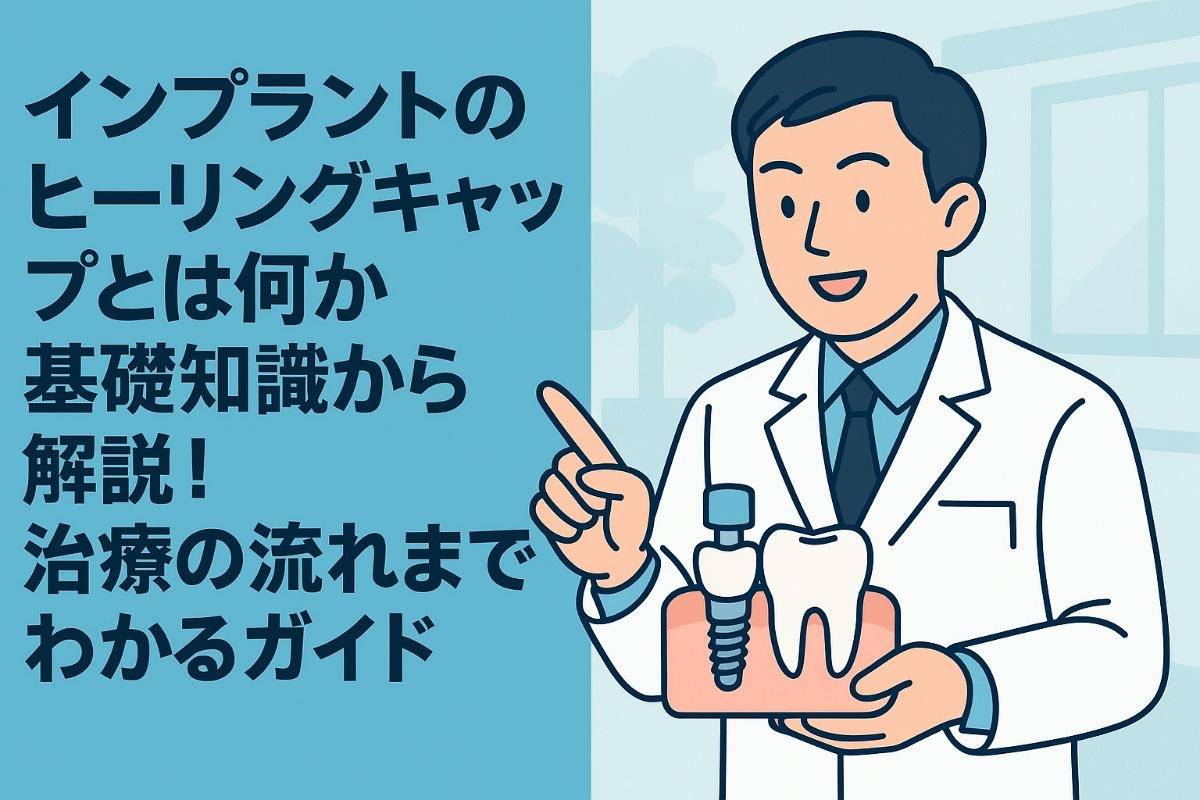 インプラントのヒーリングキャップとは何か基礎知識から解説！治療の流れまでわかるガイド