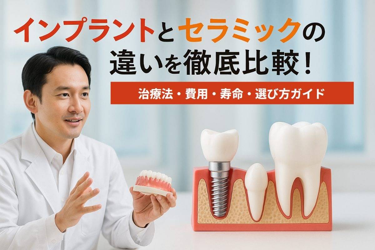 インプラントのポケット測定の方法と注意点―結果の見方や予防ポイントを解説