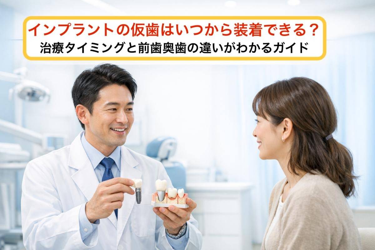 インプラントの仮歯はいつから装着できる？治療タイミングと前歯奥歯の違いがわかるガイド