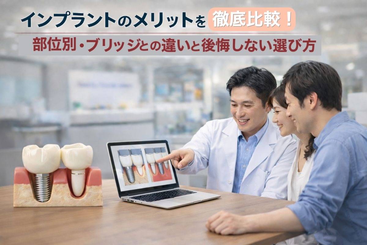 インプラントのメリットを徹底比較！部位別・ブリッジとの違いと後悔しない選び方