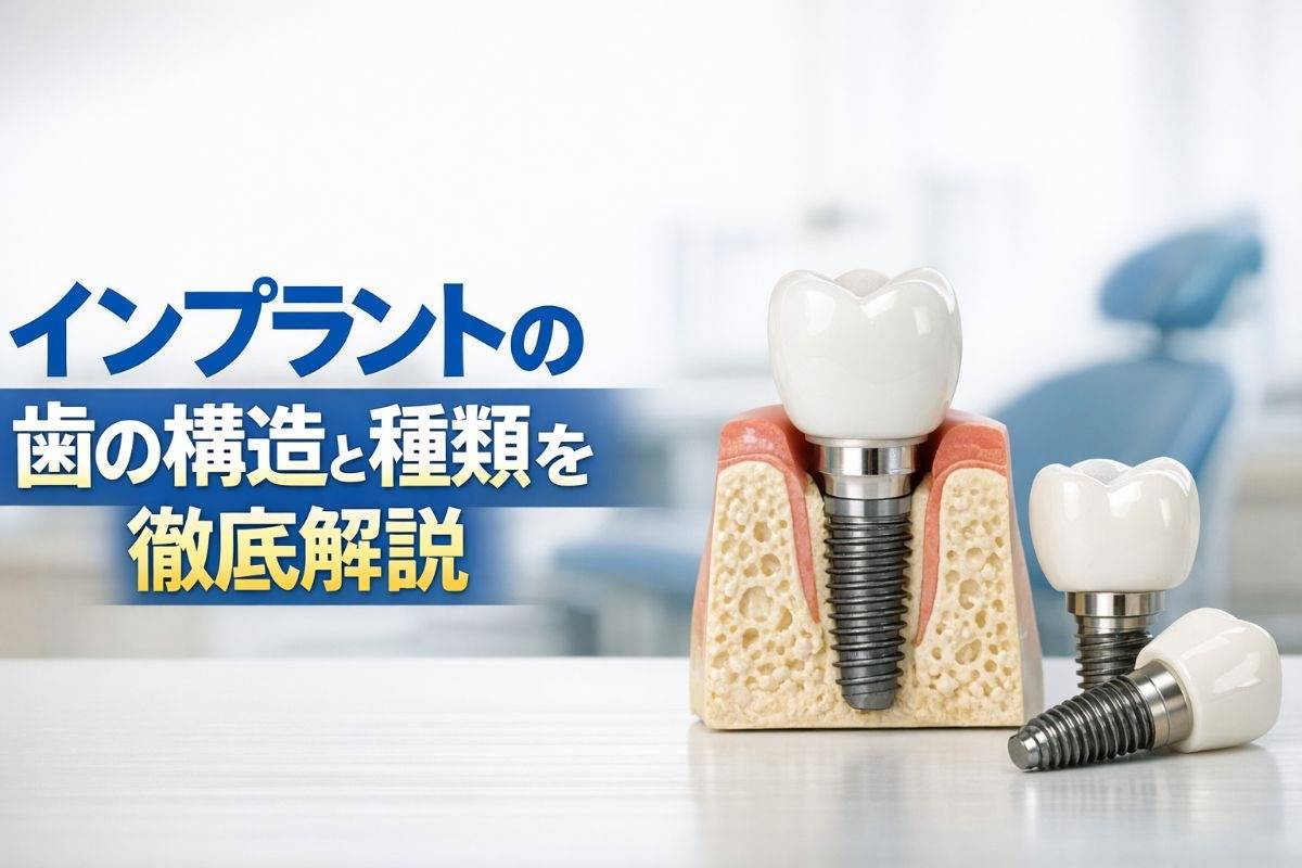 インプラントの歯の構造と種類を徹底解説