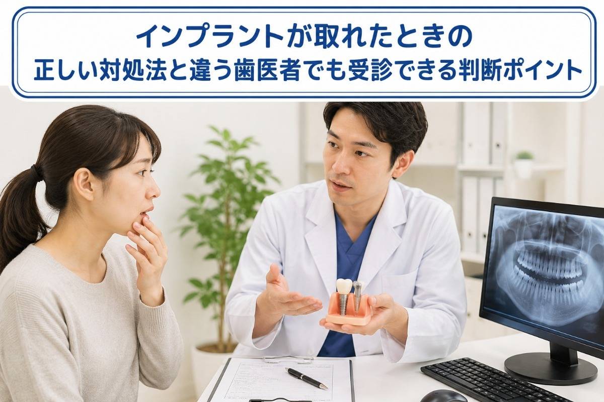 インプラントが取れたときの正しい対処法と違う歯医者でも受診できる判断ポイント