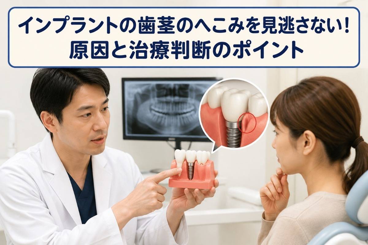 インプラントの歯茎のへこみを見逃さない！原因と治療判断のポイント