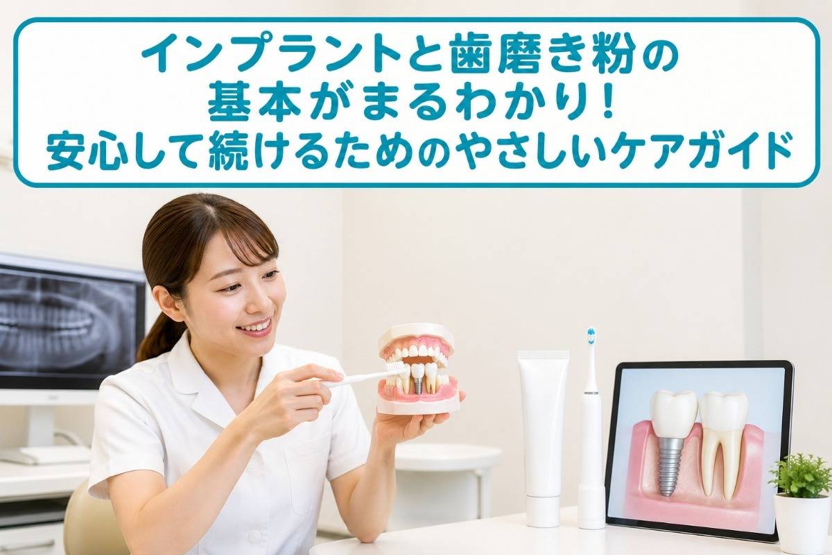 インプラントと歯磨き粉の基本がまるわかり！安心して続けるためのやさしいケアガイド